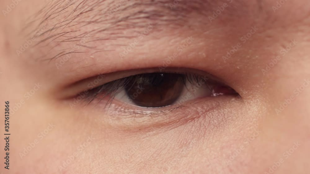 The tired eye of an Easternlooking man blinks. Blinking of a man with tired reddened eyes from