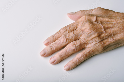 Obraz na płótnie Old woman's deform hands, Finger pain and stiffness from arthritis in senior people, Elderly healthcare concept. w salonie