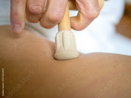 triggerpunktmassage