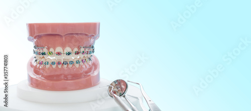 orthodontic model and dentist tool - demonstration teeth model of varities of orthodontic bracket or brace