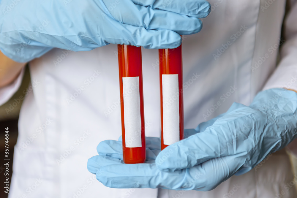 Bluegloved hands of medical worker hold two vials of blood samples for