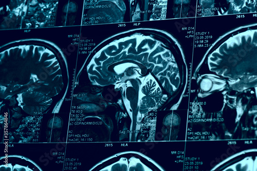 фотографія MRI scan of human brain