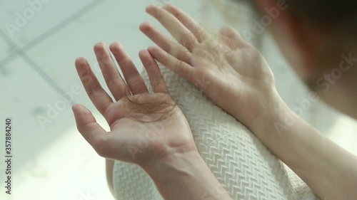 Hair problems. Hair loss. Hair loss on the hands of a girl.