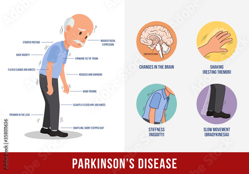 Vector of Parkinson's Disease Symptoms.