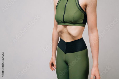 Photography The girl is sick with anorexia