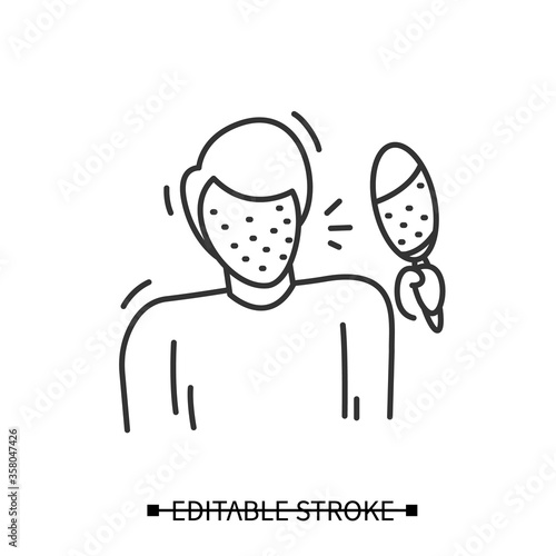 Rash icon. Male avatar, covered in pimples looking in mirror shocked. Linear concept pictogram of skin problem, allergic reaction, a and infection disease. Editable stroke vector illustration
