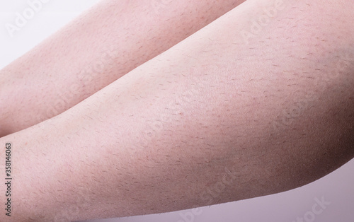 unshaven female legs close-up