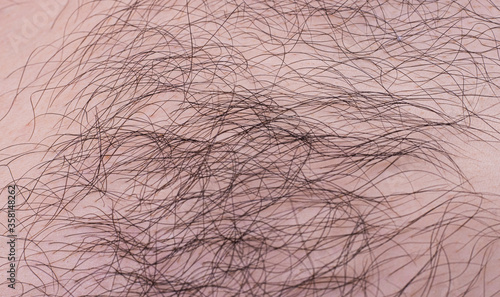 male hairy shaggy chest close-up
