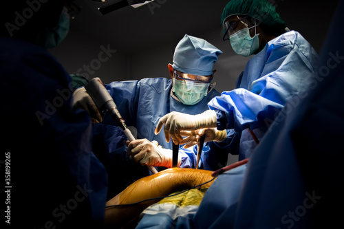 Photography High contrast photo of orthopaedic doctor perform surgery inside modern operating room with blue surgical gown suit