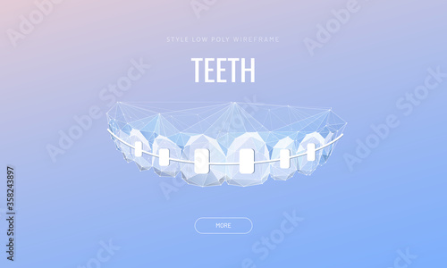 Teeth with braces low poly banner template. Orthodontic treatment poster design. Correcting uneven teeth with brackets polygonal illustration. Innovative stomatology advertising typography