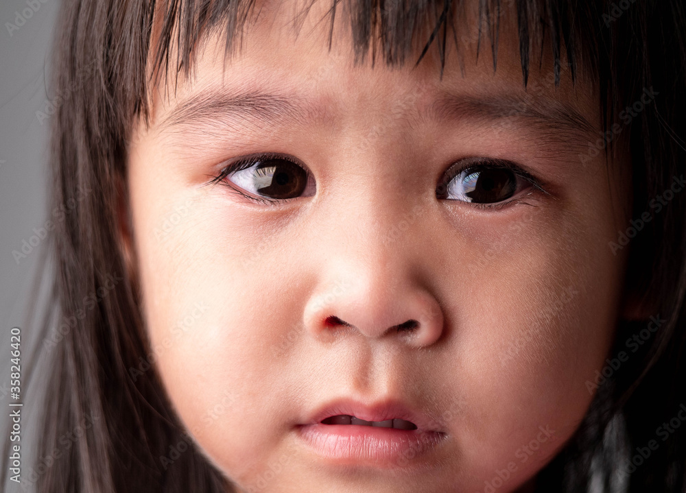 Portrait face of Asian little child girl with sad expression on dark background. Portrait face of Asian little child girl with sad expression on dark background.