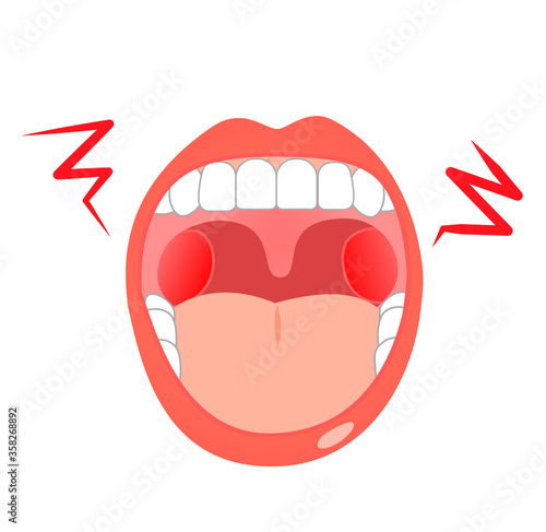 Oral throat health illustration