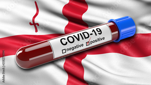 Flag of the City of London waving in the wind with a positive Covid-19 blood test tube. 3D illustration concept for blood testing for diagnosis of the new Corona virus. photo