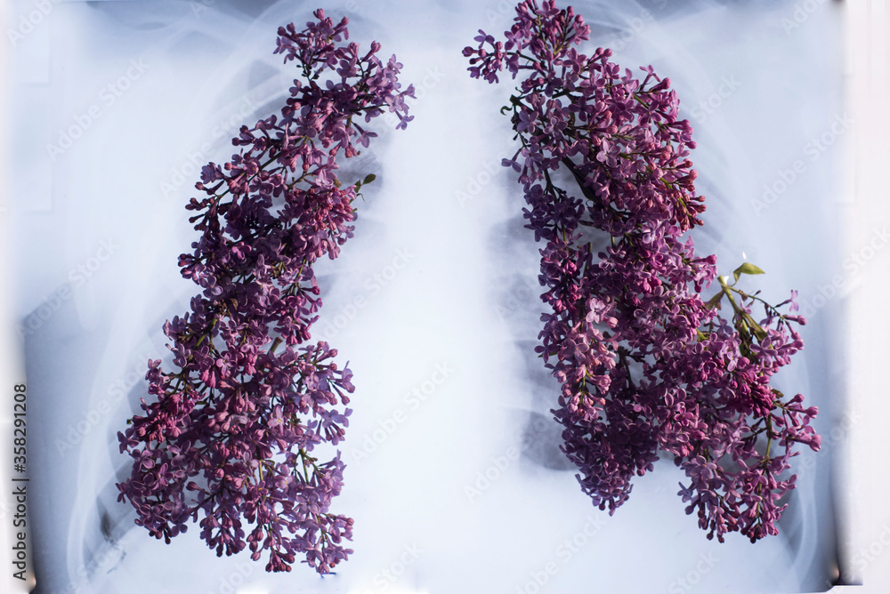 Xray of the lungs, sprouting with pink flowers in the form of the