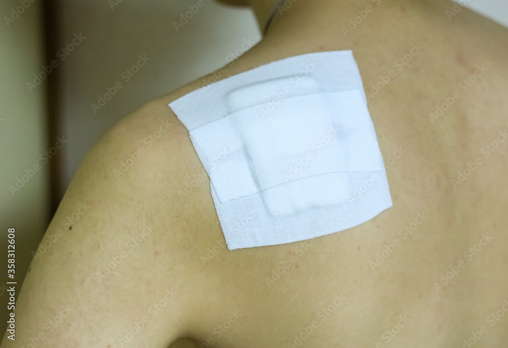 custom made wallpaper toronto digitalSquare white bandage on the shoulder of an asian man that was placed after an operation on the shoulder to remove an Epidermoid cyst