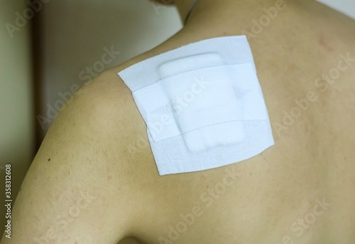 Wallpaper Mural Square white bandage on the shoulder of an asian man that was placed after an operation on the shoulder to remove an Epidermoid cyst Torontodigital.ca