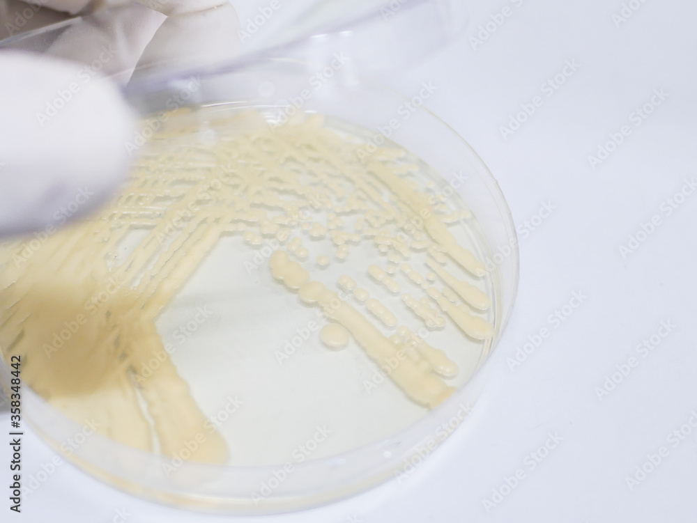 Yeast cultivation in medium agar plate for microbiology research laboratory Yeast cultivation in medium agar plate for microbiology research laboratory