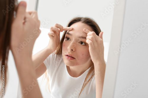 Young woman with acne problem squishing pimples in front of mirror