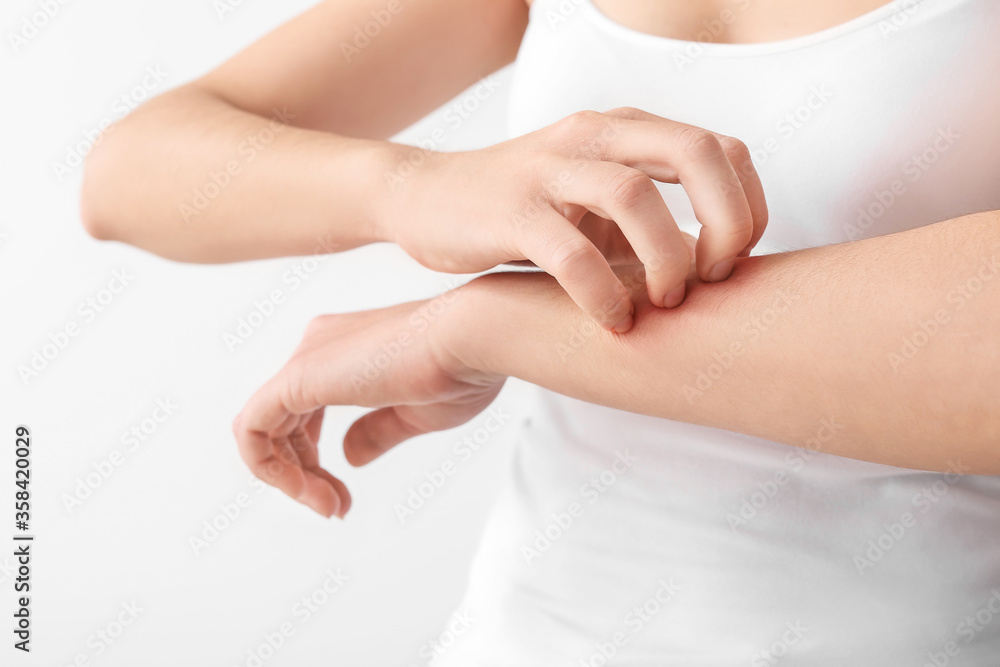 Young woman scratching her skin on light background