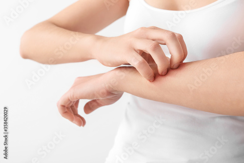 Young woman scratching her skin on light background