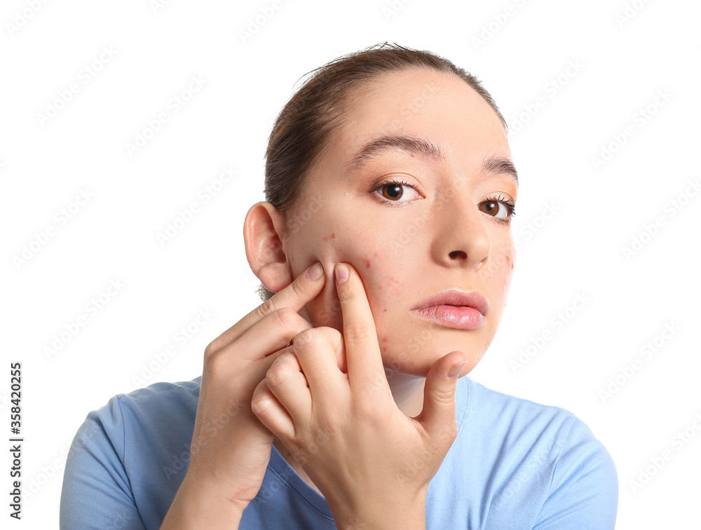 Young woman with acne problem squishing pimples on white background Young woman with acne problem squishing pimples on white background