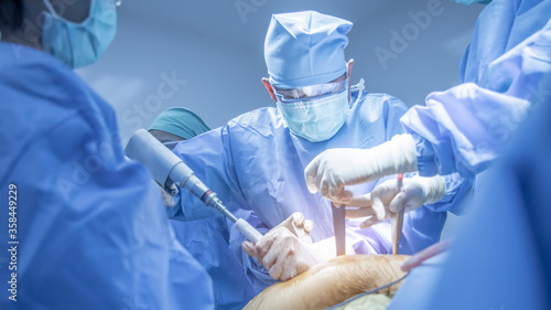 Team of doctor doing surgery inside modern operating room with orange effect. Asian orthopedic surgeon in blue surgical gown suit under surgical lamp.Fracture fixation was done in car accident patient photo