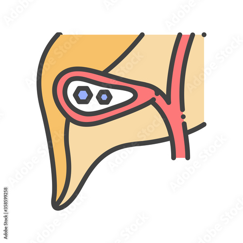 Pancreatic stones. Acute pancreatitis. Human organ concept. Sign for web page, mobile app, button, logo. Vector isolated element. Editable stroke
