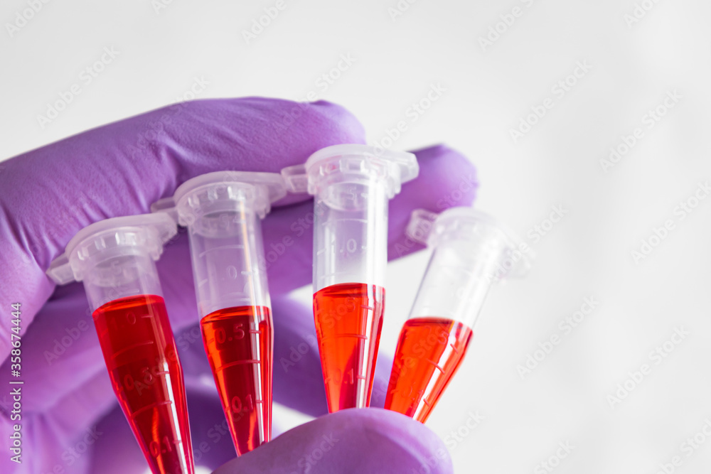 custom made wallpaper toronto digitalSeveral red samples in a 1.5 ml microcentrifuge tube in gloved hand