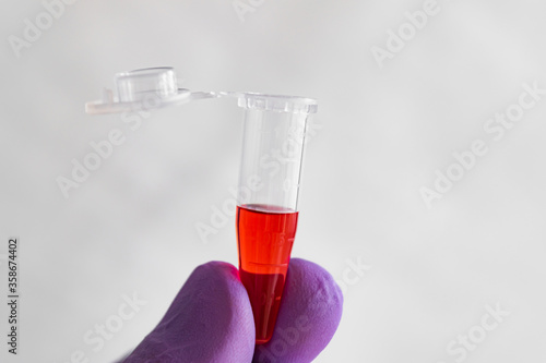 Wallpaper Mural Red sample in a 1.5 ml microcentrifuge tube in gloved hand Torontodigital.ca