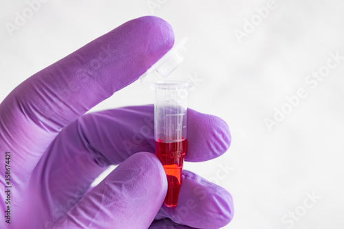 Wallpaper Mural Red sample in a 1.5 ml microcentrifuge tube in gloved hand Torontodigital.ca