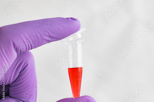 Wallpaper Mural Red sample in a 1.5 ml microcentrifuge tube in gloved hand Torontodigital.ca