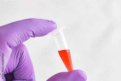 Wallpaper Mural Red sample in a 1.5 ml microcentrifuge tube in gloved hand Torontodigital.ca