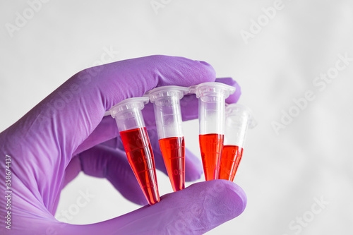 Wallpaper Mural Several red samples in a 1.5 ml microcentrifuge tube in gloved hand Torontodigital.ca