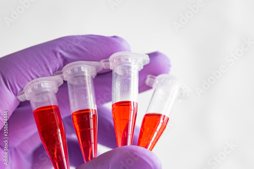 Wallpaper Mural Several red samples in a 1.5 ml microcentrifuge tube in gloved hand Torontodigital.ca