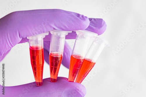 Wallpaper Mural Several red samples in a 1.5 ml microcentrifuge tube in gloved hand Torontodigital.ca
