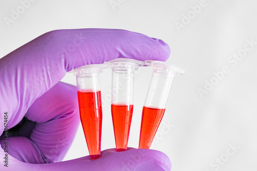 Wallpaper Mural Several red samples in a 1.5 ml microcentrifuge tube in gloved hand Torontodigital.ca