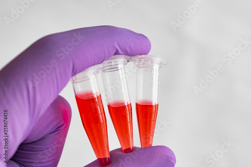 Wallpaper Mural Several red samples in a 1.5 ml microcentrifuge tube in gloved hand Torontodigital.ca