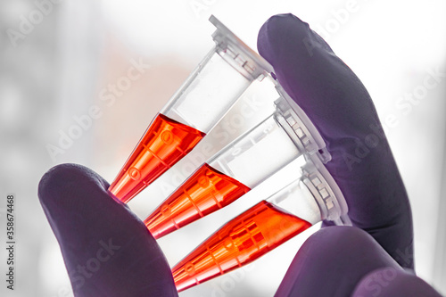 Wallpaper Mural Several red samples in a 1.5 ml microcentrifuge tube in gloved hand Torontodigital.ca