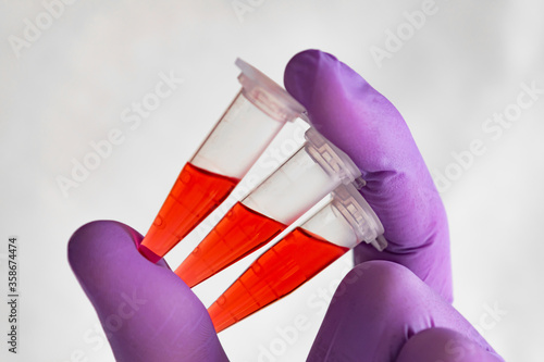 Wallpaper Mural Several red samples in a 1.5 ml microcentrifuge tube in gloved hand Torontodigital.ca