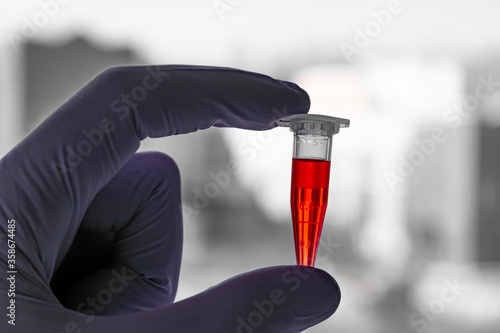 Wallpaper Mural Red sample in a 1.5 ml microcentrifuge tube in gloved hand Torontodigital.ca