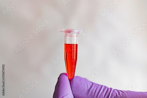 Wallpaper Mural Red sample in a 1.5 ml microcentrifuge tube in gloved hand Torontodigital.ca