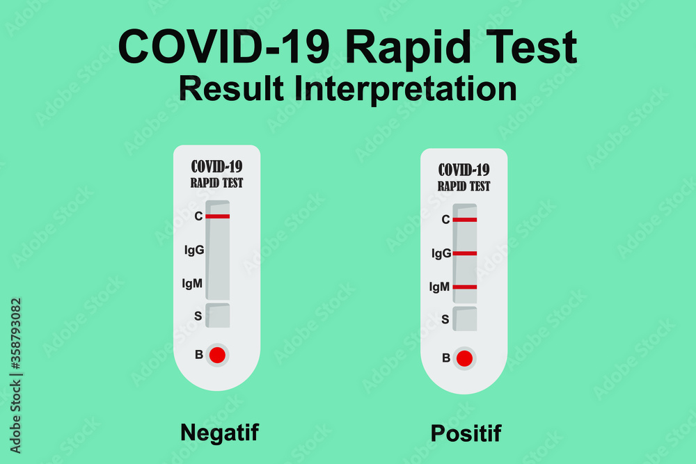 COVID 19 rapid test kit results interpretation infographics showing positive and negative Stock