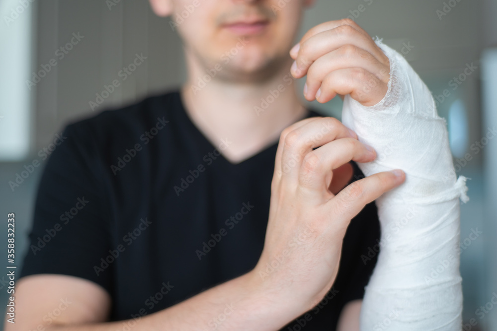 Itching under bandage. Man tries to scratch broken arm, close-up