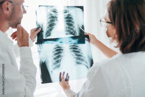Male doctor and young female colleague examining patient chest x-ray film lungs scan at radiology department in hospital. Covid-19 xray test  worldwide virus epidemic covid spreading concept image.