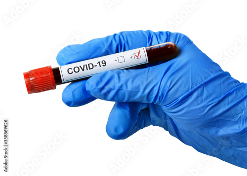 Hand in disposable glove isolated on white. Tube with coronavirus test in hand.