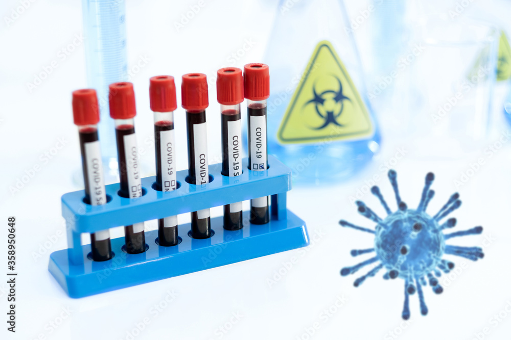 Coronavirus (COVID 19) infected blood sample in the sample tube in a scientist's hand at the laboratory on virus background. New Epidemic Coronavirus. Vaccine research to prevent the virus. Coronavirus (COVID 19) infected blood sample in the sample tube in a scientist's hand at the laboratory on virus background. New Epidemic Coronavirus. Vaccine research to prevent the virus.