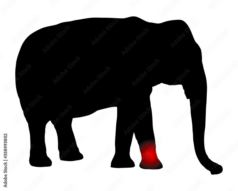 Fototapeta premium Elefant mit Schmerzen im Bein