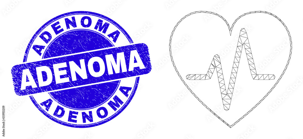 Fototapeta premium Web mesh heart pulse icon and Adenoma seal stamp. Blue vector rounded textured seal stamp with Adenoma phrase. Abstract carcass mesh polygonal model created from heart pulse icon.