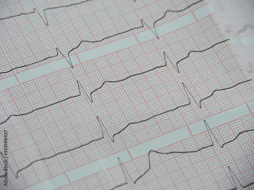 Electrocardiography of a heart on white paper with red cells, close-up at an angle.