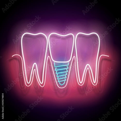 Glow Dentition with Implanted Tooth